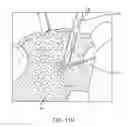 Fig. 53 - System for providing surgical access