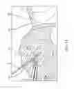 Fig. 55 - System for providing surgical access