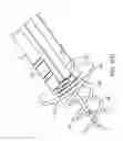 Fig. 71 - System for providing surgical access