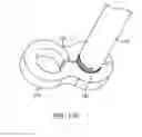 Fig. 73 - System for providing surgical access
