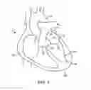 Fig. 02 - SYSTEM FOR PROVIDING SURGICAL ACCESS