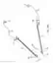 Fig. 112 - SYSTEM FOR PROVIDING SURGICAL ACCESS