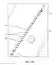Fig. 41 - SYSTEM FOR PROVIDING SURGICAL ACCESS