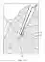 Fig. 48 - SYSTEM FOR PROVIDING SURGICAL ACCESS