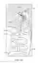 Fig. 49 - SYSTEM FOR PROVIDING SURGICAL ACCESS