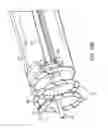 Fig. 61 - SYSTEM FOR PROVIDING SURGICAL ACCESS