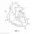 Fig. 02 - SYSTEM FOR PROVIDING SURGICAL ACCESS
