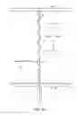Fig. 11 - SYSTEM FOR PROVIDING SURGICAL ACCESS