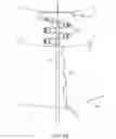 Fig. 18 - SYSTEM FOR PROVIDING SURGICAL ACCESS