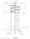 Fig. 22 - SYSTEM FOR PROVIDING SURGICAL ACCESS