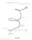 Fig. 38 - SYSTEM FOR PROVIDING SURGICAL ACCESS