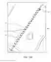 Fig. 41 - SYSTEM FOR PROVIDING SURGICAL ACCESS