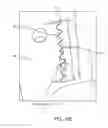 Fig. 44 - SYSTEM FOR PROVIDING SURGICAL ACCESS