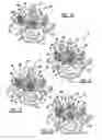 Fig. 06 - Minimally invasive vertebral laminar reconstructive plate