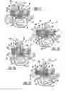 Fig. 07 - Minimally invasive vertebral laminar reconstructive plate