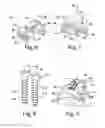 Fig. 03 - Antero-lateral plating systems and methods for spinal stabilization
