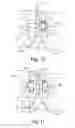 Fig. 04 - Antero-lateral plating systems and methods for spinal stabilization
