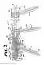 Fig. 04 - Dynamic stabilization members with elastic and inelastic sections