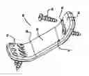 Fig. 01 - Method for surgically attaching a vertebral laminar reconstructive plate