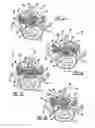 Fig. 08 - Method for surgically attaching a vertebral laminar reconstructive plate
