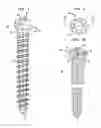 Fig. 02 - Pedicle screw assembly and methods therefor