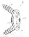 Fig. 01 - RETAINING  MECHANISM