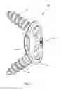 Fig. 03 - RETAINING  MECHANISM