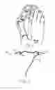 Fig. 02 - METHODS AND DEVICES FOR TREATING HALLUX VALGUS