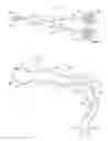 Fig. 01 - Disposable internal defibrillation electrodes