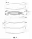 Fig. 03 - Disposable internal defibrillation electrodes