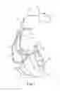 Fig. 02 - Selectively connecting the tip electrode during therapy for MRI shielding
