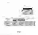 Fig. 07 - Subcutaneous cardiac sensing and stimulation system