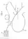 Fig. 03 - Low profile adapter for continuous connection of pacemaker lead during implantation