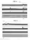 Fig. 06 - Methods and apparatus for treating bronchial restriction using electrical modulation