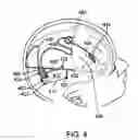 Fig. 05 - Current management system for a stimulation output stage of an implantable neurostimulation system