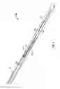 Fig. 05 - Connector design for implantable pulse generator for neurostimulation, implantable stimulation lead, and methods of fabrication