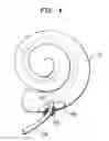 Fig. 05 - Cochlear implant having electrically nonconductive occludent for tissue openings