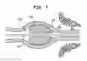 Fig. 07 - Cochlear implant having electrically nonconductive occludent for tissue openings