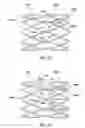 Fig. 06 - Stent With Hollow Drug-Eluting Elements