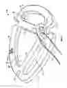 Fig. 02 - Robotic heart valve annulus sizer