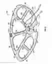 Fig. 06 - Robotic heart valve annulus sizer