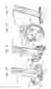 Fig. 06 - Physiologic tricuspid annuloplasty ring