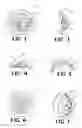 Fig. 03 - Artificial eye and method of manufacture