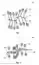 Fig. 02 - Medical device with degradation-retarding coating