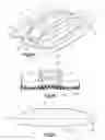Fig. 03 - Distractible intervertebral implant