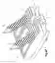Fig. 07 - Distractible intervertebral implant