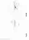 Fig. 09 - Distractible intervertebral implant