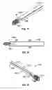 Fig. 07 - Methods and Systems for Interbody Implant and Bone Graft Delivery