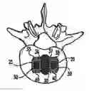 Fig. 01 - BONE GRAFTS
