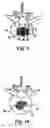 Fig. 07 - BONE GRAFTS